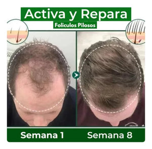 OUHOE -CRECIMIENTO DE CABELLO